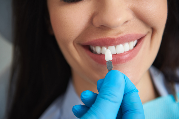 Making A Custom Smile Makeover Plan With Your Cosmetic Dentist