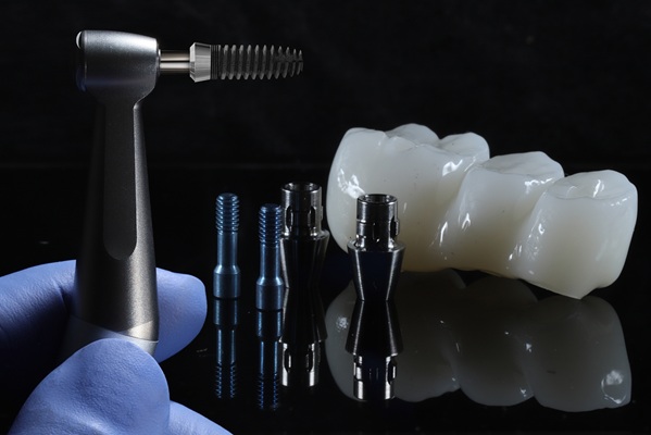 Understanding The Process For Dental Bridges