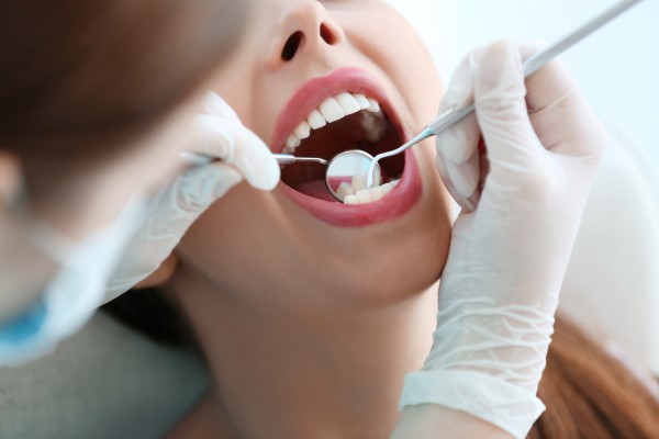 When Would A Dentist Recommend A Dental Cleaning?