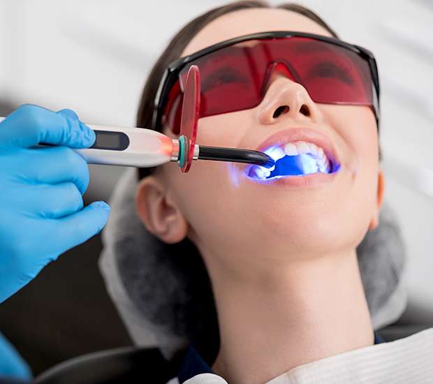 San Francisco Professional Teeth Whitening