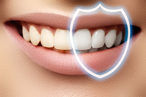 FAQs About Professional In Office Teeth Whitening